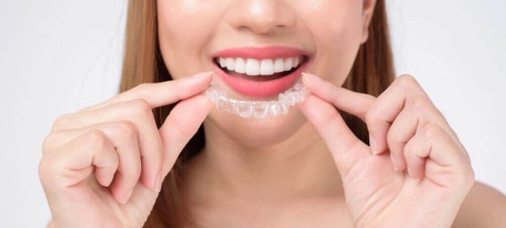 İnvisalign Ankara